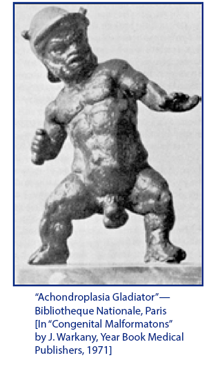 Achondroplasia Gladiator